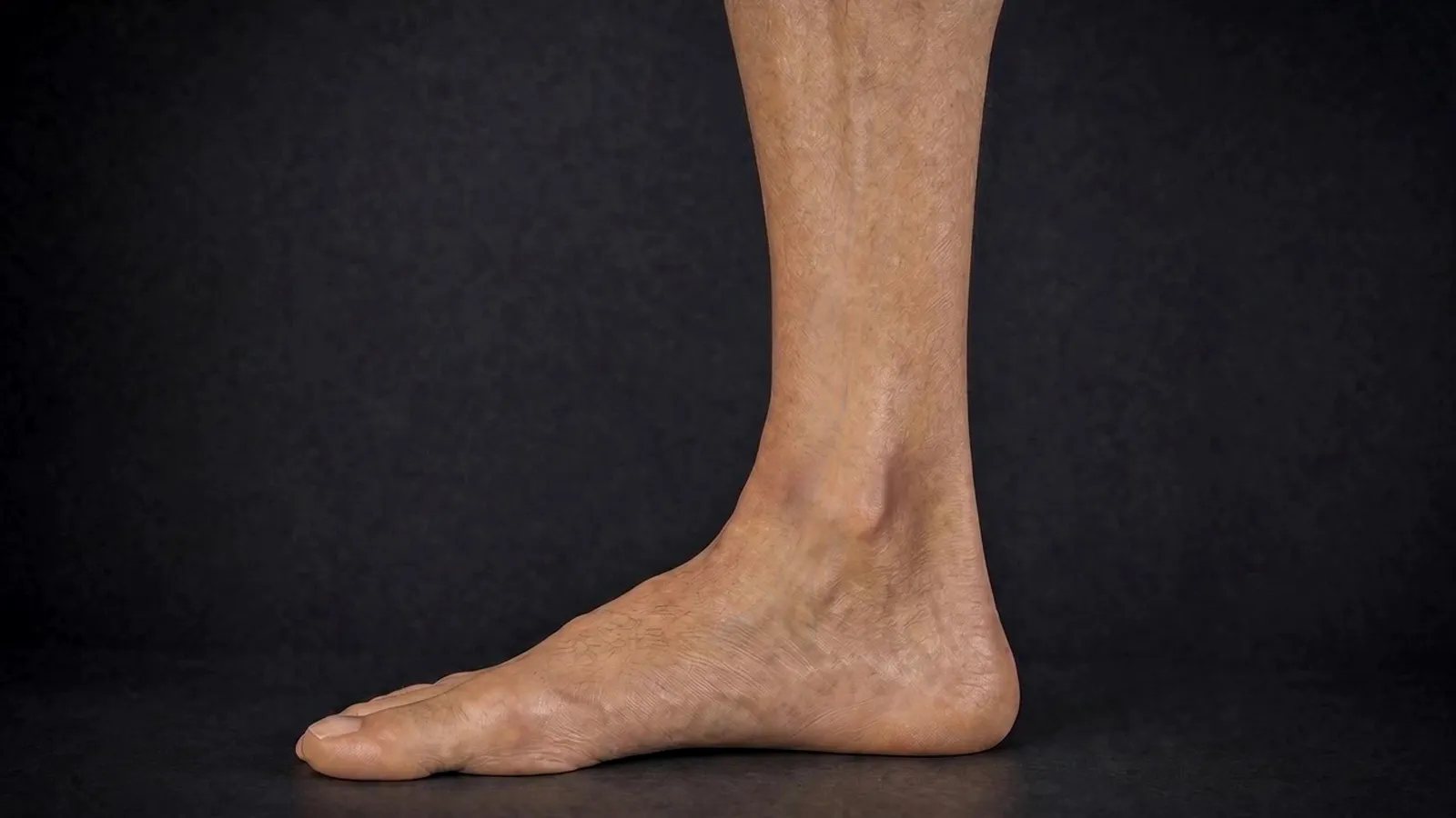 The healed ankle at the end of the journey